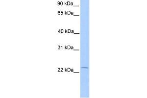 WB Suggested Anti-C5orf39 Antibody Titration: 0. (Chromosome 5 Open Reading Frame 39 (C5orf39) (N-Term) Antikörper)