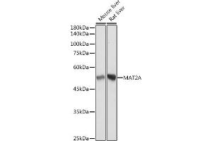 Western blot analysis of extracts of various cell lines, using MA antibody (ABIN7268487) at 1:3000 dilution.