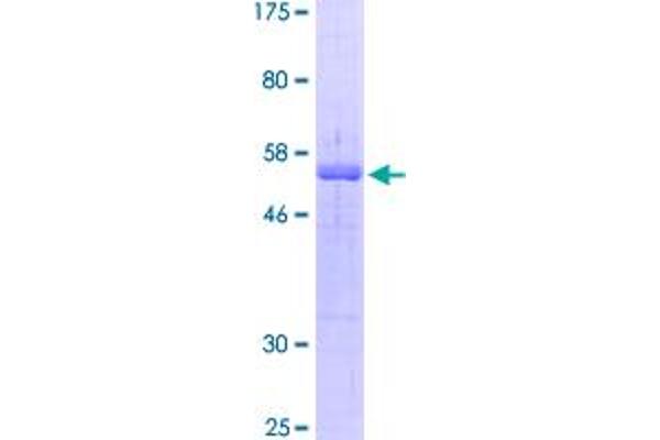 BCL10 Protein (AA 1-233) (GST tag)