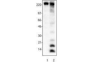 Western Blotting (WB) image for anti-Acetylated Lysine (acetylated) antibody (ABIN2666081) (Acetylated Lysine Antikörper  (acetylated))