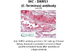 Image no. 1 for anti-Dehydrogenase/reductase (SDR Family) Member 7 (DHRS7) (C-Term) antibody (ABIN1733630) (DHRS7 Antikörper  (C-Term))