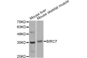 Western blot analysis of extracts of various cell lines, using BIRC7 Antibody. (BIRC7 Antikörper)