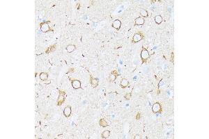Immunohistochemistry of paraffin-embedded rat brain using βIII-Tubulin/β3-Tubulin  at dilution of 100 (40x lens). (TUBB3 Antikörper)