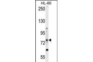 ABCD1 Antikörper  (AA 257-285)