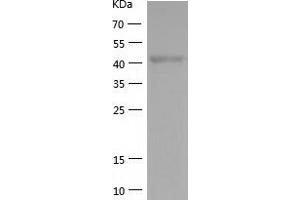 Western Blotting (WB) image for Mitogen-Activated Protein Kinase 8 (MAPK8) (AA 1-427) protein (His tag) (ABIN7123995) (JNK Protein (AA 1-427) (His tag))