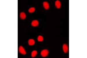 Immunofluorescent analysis of BRF1 staining in NIH3T3 cells. (BRF1 Antikörper  (Center))