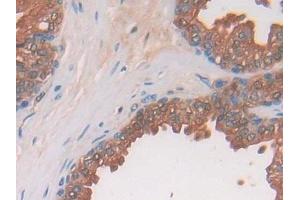 Immunohistochemistry (IHC) image for anti-Acid Phosphatase, Prostate (ACPP) (AA 217-386) antibody (ABIN7431248)