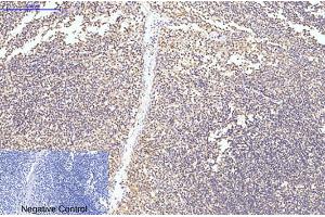 Immunohistochemical analysis of paraffin-embedded human tonsil tissue. (Caspase 8 Antikörper)