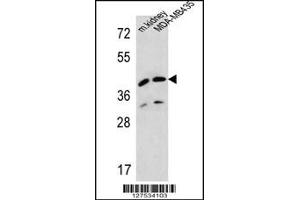 Western blot analysis in MDA-MB435 cell line and mouse kidney tissue lysates (35ug/lane).