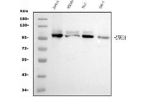 Western blot analysis of UBE3A using anti-UBE3A antibody (ABIN7599564).