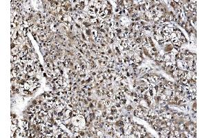 IHC analysis of NOLA1/GAR1 using anti-NOLA1/GAR1 antibody (ABIN7602076). (GAR1 Antikörper  (AA 58-165))