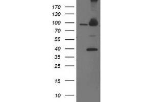 Western Blotting (WB) image for anti-Proteasome (Prosome, Macropain) 26S Subunit, Non-ATPase, 2 (PSMD2) antibody (ABIN1500482) (PSMD2 Antikörper)