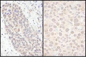 Immunohistochemistry (IHC) image for anti-Forkhead Box O3 (FOXO3) (AA 250-300) antibody (ABIN7454631)