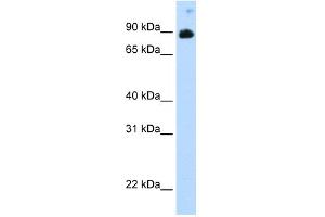 WB Suggested Anti-STAT6 Antibody Titration:  0. (STAT6 Antikörper  (C-Term))
