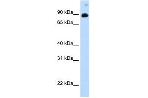 WB Suggested Anti-STAT6 Antibody Titration:  0.