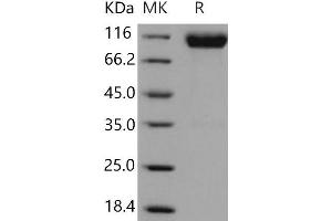 Western Blotting (WB) image for Fibroblast Growth Factor Receptor 1 (FGFR1) (Active) protein (Fc Tag) (ABIN7320382) (FGFR1 Protein (Fc Tag))