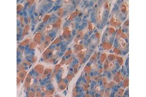 Used in DAB staining on fromalin fixed paraffin- embedded stomach tissue (DPP3 Antikörper  (AA 2-263))