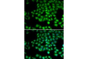 Immunofluorescence analysis of HeLa cells using TRPM2 antibody (ABIN5973615). (TRPM2 Antikörper)