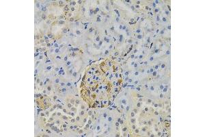 Immunohistochemistry of paraffin-embedded rat kidney using FLT3 antibody (ABIN6131275, ABIN6140693, ABIN6140696 and ABIN6223885) (40x lens). (FLT3 Antikörper)