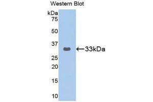 Western blot analysis of the recombinant protein. (GRAP2 Antikörper  (AA 77-325))
