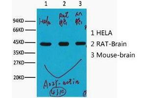 Western Blot (WB) analysis of HeLa (1), Rat Brain (2), Mouse Brain (3), (A02) diluted at 1:10000. (beta Actin Antikörper)