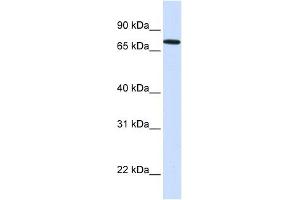 SETDB2 antibody used at 1 ug/ml to detect target protein.