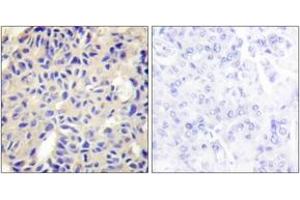 Immunohistochemistry (IHC) image for anti-Collagen, Type V, alpha 2 (COL5A2) (AA 1-50) antibody (ABIN1534344)