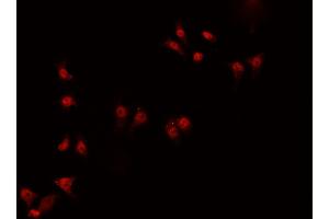 ABIN6266919 staining HeLa  cells by IF/ICC. (ZNF174 Antikörper  (Internal Region))