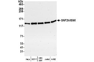 Western Blotting (WB) image for anti-SWI/SNF Related, Matrix Associated, Actin Dependent Regulator of Chromatin, Subfamily A, Member 5 (SMARCA5) (AA 50-100) antibody (ABIN7452054)