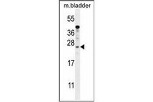 Western blot analysis of KIAA1644 antibody (N-term) in mouse bladder tissue lysates (35ug/lane). (SHISAL1/KIAA1644 Antikörper  (N-Term))