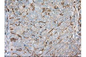 Immunohistochemical staining of paraffin-embedded liver tissue using anti-ALDH3A1 mouse monoclonal antibody. (ALDH3A1 Antikörper)