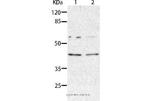 Western blot analysis of HepG2 and A549 cell, using AIMP2 Polyclonal Antibody at dilution of 1:350 (AIMP2 Antikörper)