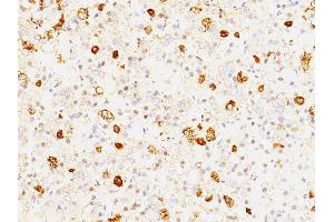 Formalin-fixed, paraffin-embedded human Pituitary stained with FSH beta Mouse Monoclonal Antibody (FSHb/1062). (FSHB Antikörper)