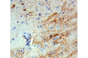 Used in DAB staining on fromalin fixed paraffin-embedded Brain tissue (INHBB Antikörper  (AA 50-404))