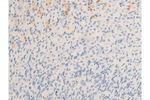 Immunohistochemistry (IHC) image for anti-Microphthalmia-Associated Transcription Factor (MITF) (pSer180), (pSer73) antibody (ABIN6255037)