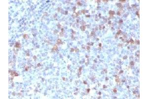 IHC testing of FFPE human tonsil with Cdc20 antibody (clone CLDC20-1) (CDC20 Antikörper)