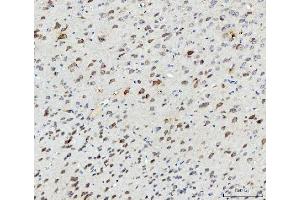 IHC analysis of SSH3BP1/ABI1 using anti-SSH3BP1/ABI1 antibody (ABIN3043515).
