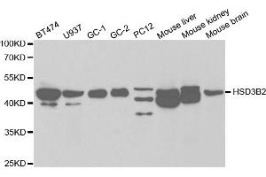 Western blot analysis of extracts of various cell lines, using HSD3B2 antibody. (HSD3B2 Antikörper)
