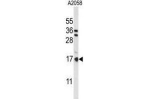 Western blot analysis of Parathymosin / PTMS (arrow) in A2058 cell line lysates (35ug/lane) using Parathymosin / PTMS  Antibody (C-term).