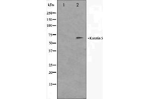 Western blot analysis on HepG2 cell lysate using Keratin 5 Antibody. (Cytokeratin 5 Antikörper  (C-Term))
