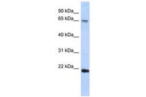 Image no. 1 for anti-DNA repair and recombination protein RAD54B (RAD54B) (C-Term) antibody (ABIN6740311)