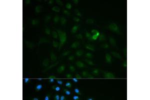 Immunofluorescence analysis of MCF-7 cells using CD79B Polyclonal Antibody (CD79b Antikörper)