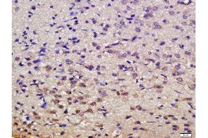 Formalin-fixed and paraffin embedded rat brain labeled with Rabbit Anti-MSK1 (Ser376) Polyclonal Antibody, Unconjugated  at 1:200 followed by conjugation to the secondary antibody and DAB staining