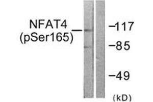 Western blot analysis of extracts from HeLa cells treated with Ca+ 40nM 30', using NFAT4 (Phospho-Ser165) Antibody.