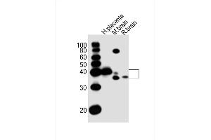 All lanes : Anti-J Antibody (C-term) at 1:1000 dilution Lane 1: human placenta lysates Lane 2: mouse brain lysates Lane 3: rat brain lysates Lane 4: rat brain lysates Lysates/proteins at 20 μg per lane. (JAM3 Antikörper  (C-Term))