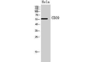 Western Blotting (WB) image for anti-Ectonucleoside Triphosphate diphosphohydrolase 1 (ENTPD1) (Internal Region) antibody (ABIN3178932) (CD39 Antikörper  (Internal Region))