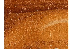 ABIN6255298 and ABIN6267360 at 1/100 staining Mouse brain tissue by IHC-P.