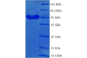 SDS-PAGE (SDS) image for Fc Fragment of IgE, Low Affinity II, Receptor For (CD23) (FCER2) (AA 48-321) protein (His-SUMO Tag) (ABIN5709507) (FCER2 Protein (AA 48-321) (His-SUMO Tag))