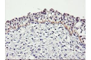 Image no. 2 for anti-Dystrobrevin, beta (DTNB) antibody (ABIN1497913) (Dystrobrevin beta Antikörper)