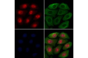 ABIN7094628 and ABIN7098678 staining Hela cells by IF/ICC.